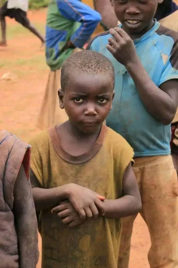 Fighting Malnutrition In Children
